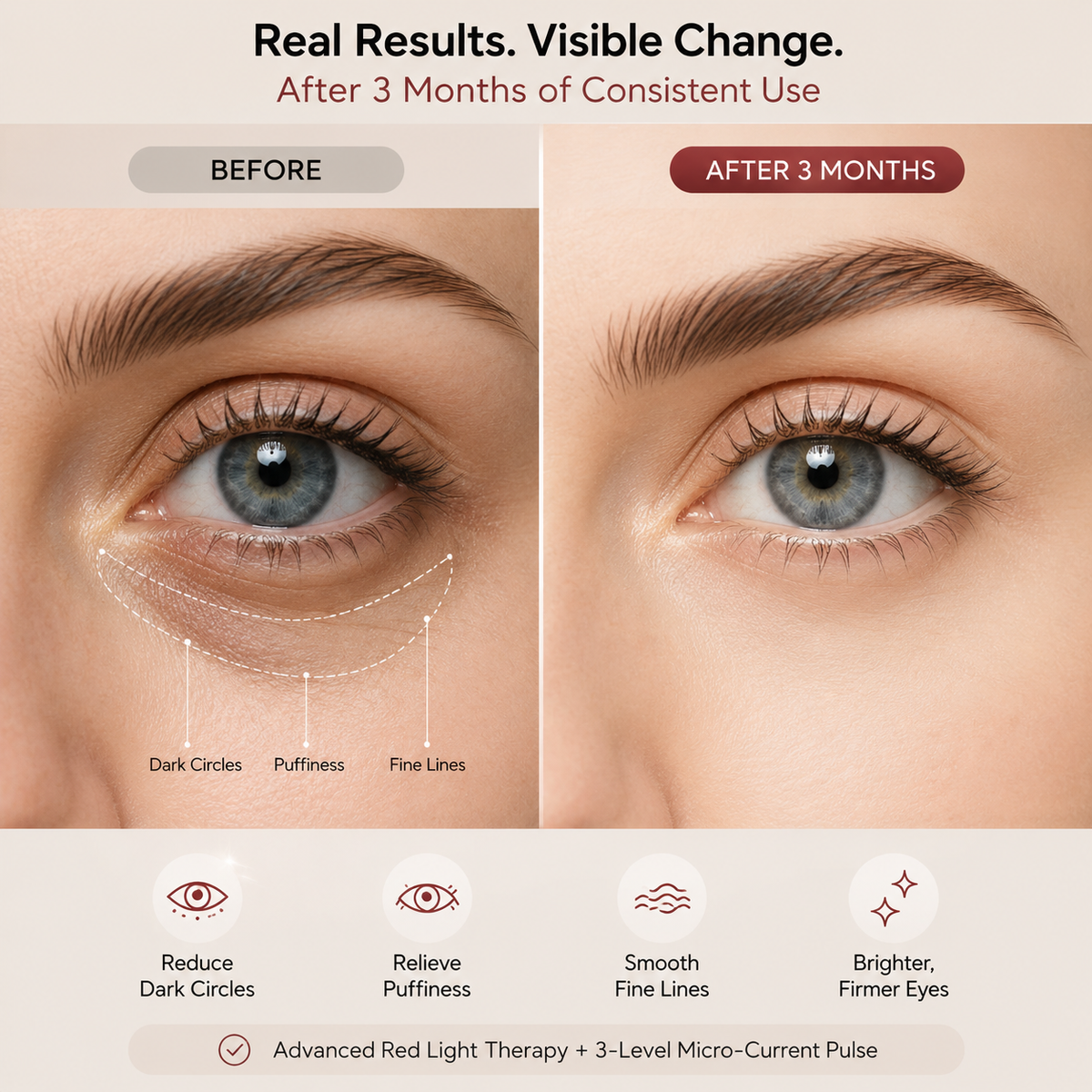 EMS Microcurrent Red Light Eye Therapy Device, for Dark Circles, Puffiness & Fine Lines